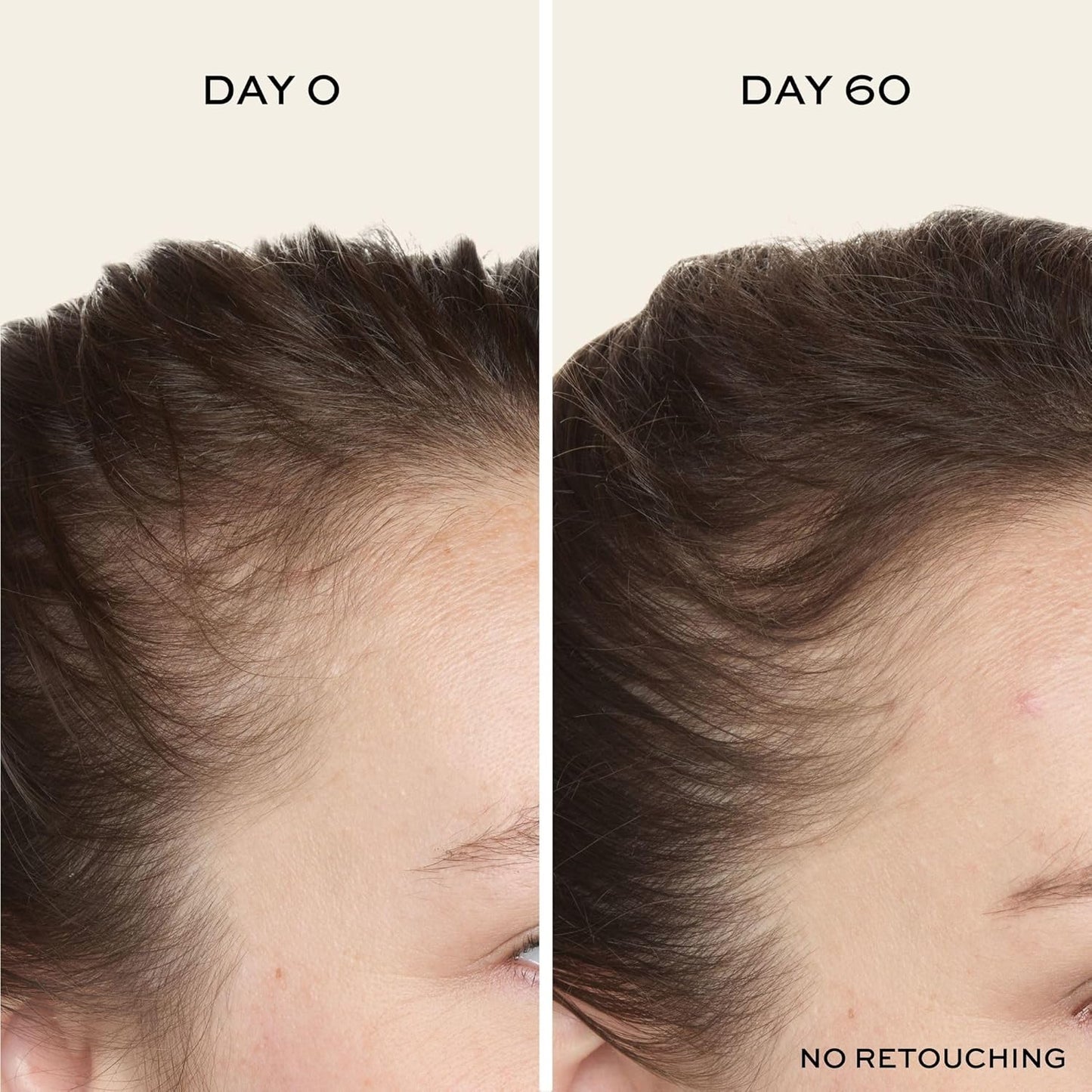 John Frieda ULTRAFiller+ Scalp Serum – Økt Hårtetthet & Fyldigere Hår (Biotin + Peptider)
